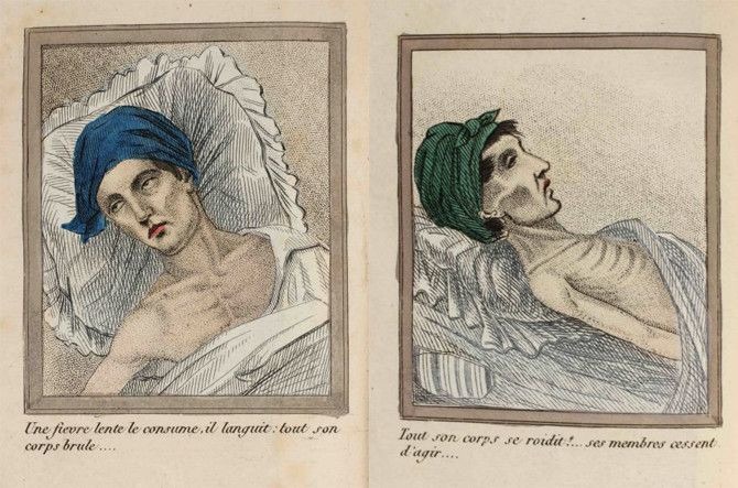 L'onanisme compulsif, une pathologie silencieuse